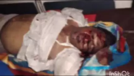 ల్యాదల్ల గ్రామానికి చెందిన వ్యక్తిరోడ్డు ప్రమాదంలో గాయపడి చికిత్స పొందుతూ కానిస్టేబుల్ మృతి