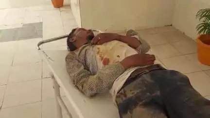 कुरडेग: चापाबारी के पास मोटरसाइकिल से गिरने से नशे में धुत युवक हुआ घायल, सदर अस्पताल में भर्ती