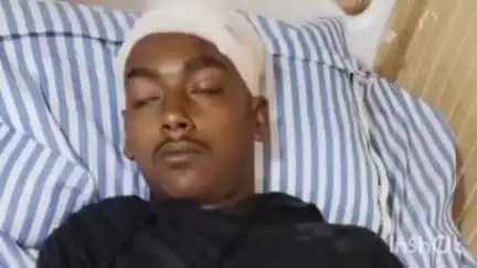 तुरकौलिया: बेलवतिया में बच्चों के विवाद में रविवार को हुई मारपीट में युवक हुआ घायल, पुलिस जांच में जुटी
