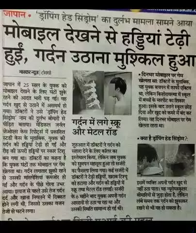 जापान :
ज्यादा मोबाइल देखना खतरनाक '
हड्डियां भी टेंढ़ी  हो सकती हैं ।
#kasganj #viral #news #health #mobile #sahawar