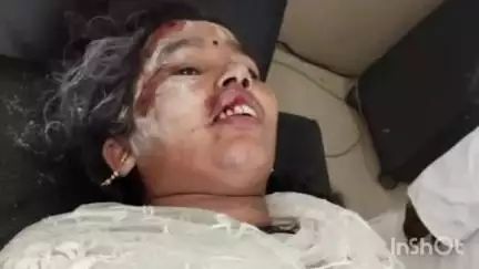 बंशीधरनगर (नगर उंटारी): सिंघी ताली सड़क पर बाइक फिसलने से बहियार कलां गांव की महिला और बच्ची घायल, अस्पताल में भर्ती