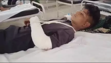 छोटी सरवन: कोईवाव गांव में घर के बाहर खेल रहे किशोर को बाइक ने मारी टक्कर, हाथ पर लगी चोट