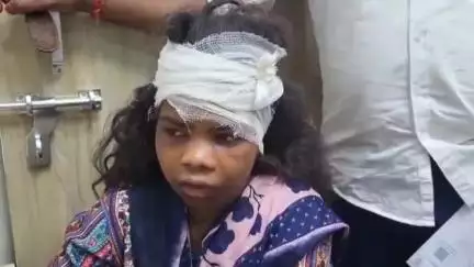 काको: मई के पास भट्टे पर काम करने वाली महिला को पति ने मारपीट कर किया घायल, इलाज जारी