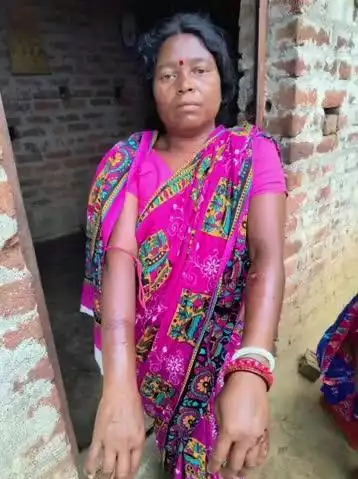 पटमदा: कुत्ते के काटने पर महिला ने दिखाई हिम्मत, जबड़ा फाड़कर मार डाला, आवारा कुत्तों ने 2 दिनों में 30 से अधिक लोगों को किया घायल