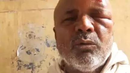 बलिया: जगदीशपुर गांव में दो पक्षों के बीच जमकर हुई मारपीट