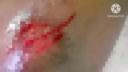 মন্দিরবাজার: লক্ষীকান্তপুর এলাকায় মোটর ভ্যানের ধাক্কায় আহত হয় এক সাইকেল চালক