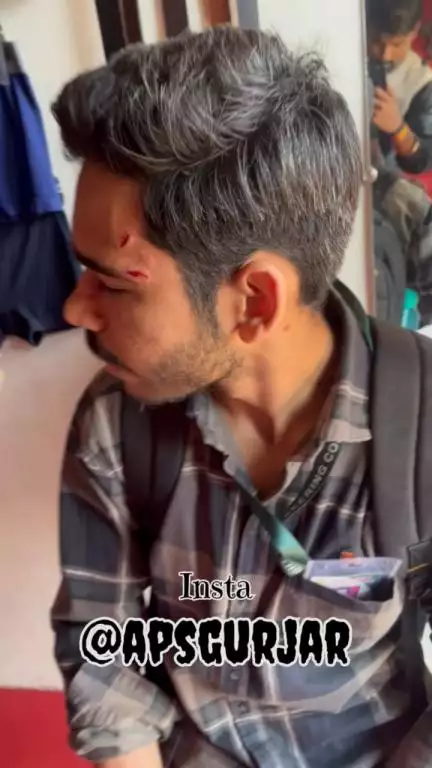 Accident case 🥺

Respect girls help poor help animals 

#apsgurjar #help #accident #support #gwalior