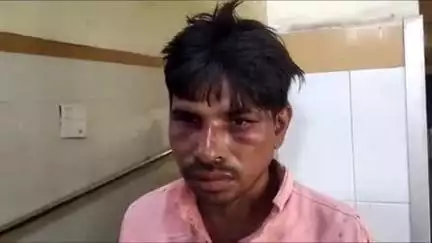 अतर्रा: मझिवा सानी में दबंगों ने मामूली बात को लेकर युवक के साथ की मारपीट, युवक को अस्पताल में भर्ती कराया गया, इलाज शुरू