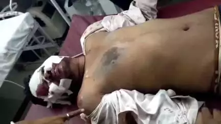 बेगुं: बेगू नगर के चैची मार्ग पर स्थित श्मशान के पास बैलों ने बाइक सवार को किया घायल, घायल को कोटा किया रेफर