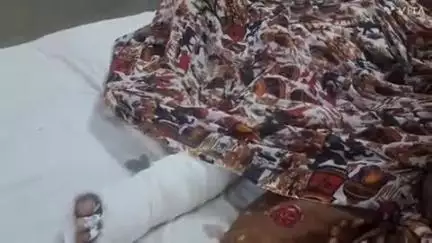 बागीदौरा: चिरोला बड़ा गांव में घर के बाहर खेल रहे 7 वर्षीय बच्चे को बस ने मारी टक्कर, एमजी अस्पताल में कराया गया भर्ती
