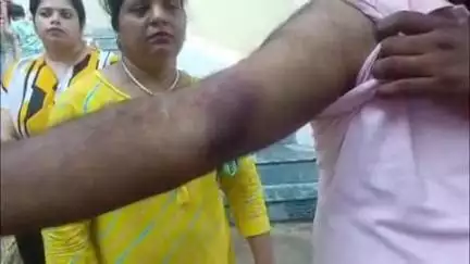 रामपुर बघेलान: वेकेशन वैली वाटर पार्क में गुंडागर्दी, जन्मदिन मनाने पहुंचे परिवार से मारपीट, महिलाएं और बच्चे भी नहीं बचे