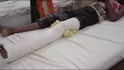 छोटी सरवन: भागीडेरी गांव में निर्माणाधीन मकान की दीवार मजदूर पर ढहने से पैर में लगी चोट, एमजी अस्पताल में उपचार जारी