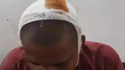 साहेबपुर कमाल: रसलपुर बहलोरिया में छत पर चदरा चढ़ाने के विवाद में युवक से मारपीट, सिर फोड़ा