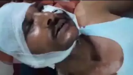 ग्राम चितहरी के समीप रास्ता रोककर अज्ञात लोगों ने युवक से मारपीट कर छीनीं मोबाइल और कीमती चीजें, जांच में जुटी पुलिस