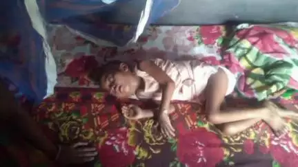 रायडीह: गुमला: कांसीर की चार वर्षीय बच्ची आंख के कैंसर से पीड़ित, प्रशासन और लोगों से मदद की आस