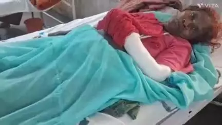 बागीदौरा: बड़ोदिया गांव में खेत में काम करते समय 50 वर्षीय महिला को बैल ने उछाल दिया, गंभीर चोट के कारण एमजी अस्पताल में रेफर