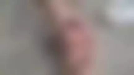 বারাসত ২: বেলিয়াঘাটা-রাজারহাট রোডে হাড়োয়া খাল এলাকায় দুটি বাইকের সংঘর্ষ, আহত এক বাইক আরোহী