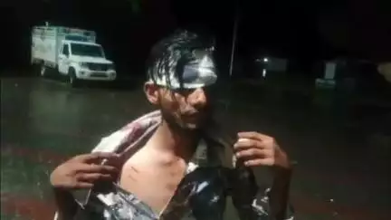 आबू रोड: आबूरोड के मावल चौकी के पास एक होटल पर पर्यटकों के साथ हुई मारपीट, बियर की बोतल से एक पर्यटक गंभीर घायल