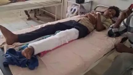 पाकरटांड: पाकरटांड के केउन्दडीह में साइकिल सवार किशोर ने पेड़ को मारी टक्कर, पैर टूटा, अस्पताल में भर्ती