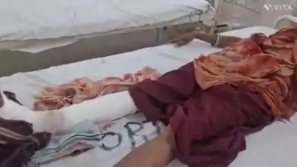 बागीदौरा: शहर के कलिंजरा रोड पर बाइक से गिरकर एक 30 वर्षीय महिला को लगी गंभीर चोट, एमजी अस्पताल में किया गया रेफर