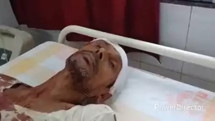 कटोरिया: रामपुर गांव में भूमि विवाद में पड़ोसियों ने एक वृद्ध पर हमला कर किया जख्मी
