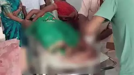 पाकरटांड: सिकरियाटांड जंगल में मोटरसाइकिल से धक्का लगने से महिला घायल, सदर अस्पताल में भर्ती