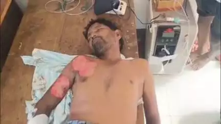 బైట కొడియంబేడు వద్ద ద్విచక్ర వాహనాన్ని లారీ ఢీకొని వ్యక్తి మృతి