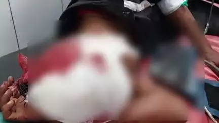 सोजत: सोजत तहसील के बागावास के निकट सड़क किनारे घायल मिले अज्ञात को अस्पताल में उपचार के लिए भर्ती किया गया