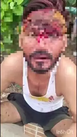 टूंडला: एटा रोड पर शराब के नशे में मोहल्लेवासियों को गाली दे रहे युवक के साथ धक्का-मुक्की, युवक को आई चोटें