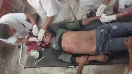 बांसजोर: बांसजोर गुमला देवनदी मोड़ पर अज्ञात वाहन की चपेट में आने से एक व्यक्ति घायल, रांची रिम्स रेफर