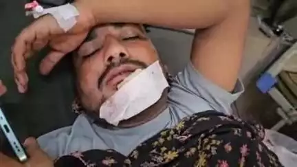 लाडपुरा: कैथून थाना इलाके के अरनिया गांव में फोन पर कहासुनी के बाद युवक से मारपीट, जबड़ा तोड़ा, MBS अस्पताल में भर्ती