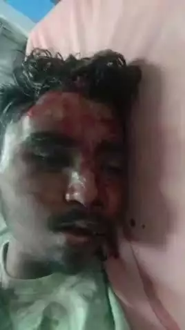 ఆర్మూర్: సిహెచ్ కొండూరు గ్రామానికి చెందిన సిద్దు అనే యువకుడు హైదరాబాదులో రోడ్డు ప్రమాదంలో మృతి