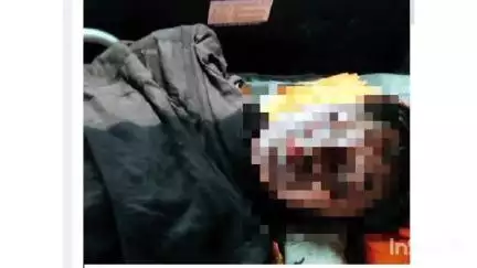 नांदुरा: नांदुरा येथील भिम नगर येथे घराच्या गच्चीवर खेळण्याकरिता गेलेल्या चिमुकल्याला लागला वीजेचा शॉक, चिमुकला गंभीर जखमी