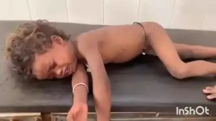 मनोहरपुर: मनोहरपुर- बरंगा तालाब में डूबने से शिशु गंभीर, मनोहरपुर सीएचसी में इलाज जारी