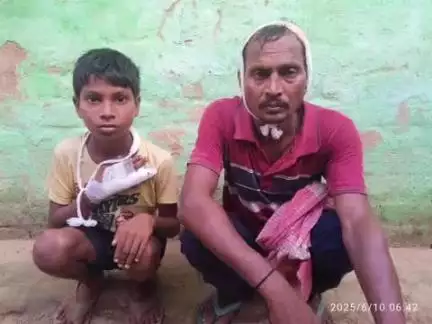 खड़गपुर: महादेवपुर गांव: बेटे की अंगुली टूटने पर विवाद, पिता पर लाठी से हमला, सीएचसी खड़गपुर में इलाज जारी