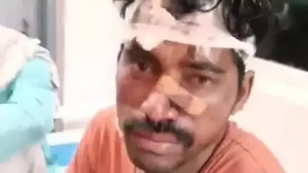 रुन्नी सैदपुर: सोनपुरवा गांव: खाना खाने के बहाने बुलाकर युवक की बेरहमी से पिटाई, अस्पताल में भर्ती