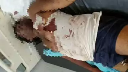बाह: बाह में मारुति वेन की ट्रक से टक्कर, 1 युवक की मौत और 2 घायल