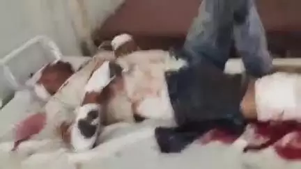 रसूलाबाद: बिरिया गढ़ेवा के समीप 2 पिकअप आपस में टकराईं, 1 घायल को सीएचसी में उपचार के बाद हैलट रेफर किया गया