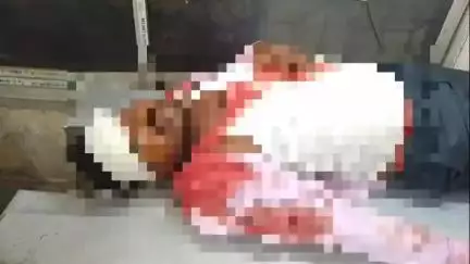 আউশগ্রাম ১: গুসকরার বলগোনা মোড় এলাকায় লরির সঙ্গে চারচাকা গাড়ির মুখোমুখি সংর্ঘষ, গুরুতর জখম  চারচাকা গাড়ির তিন যাত্রী