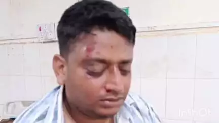 मेदिनीनगर (डालटनगंज): जेलहाता ओवरब्रिज पर अज्ञात वाहन की टक्कर से एक युवक गंभीर रूप से घायल, अस्पताल में भर्ती