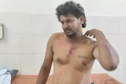 పుంగనూరు: మర్లపల్లి గ్రామం వద్ద ఓ వ్యక్తిపై దాడి వ్యక్తికి గాయాలు.