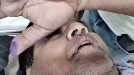 मुरादाबाद: सिविल लाइंस थाना क्षेत्र में मिनी मेट्रो पलटने से दंपत्ति घायल, इलाज के लिए जिला अस्पताल में भर्ती