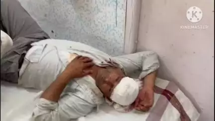 जावद: रूपपुरा बावड़ी में ट्रैक्टर निकालने को लेकर विवाद, दो बार हमला, 5 घायल, दो की हालत गंभीर