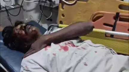 నల్లమల్ల ఘాట్ రోడ్ లో రోడ్డు ప్రమాదం, ఒక వ్యక్తికి గాయాలు