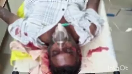 ఉదయగిరి: బొమ్మరాజు చేరువు సమీపంలో  అదుపు తప్పి బోల్తా పడ్డ బైక్. ఓ వ్యక్తి తో పాటు మరో ఇద్దరికీ గాయాలు