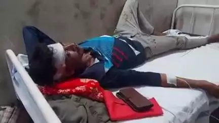 शहपुरा: रैली गांव में युवक पर पड़ोसियों ने लाठी से किया जानलेवा हमला, युवक गंभीर रूप से घायल