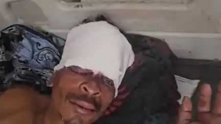 लाडपुरा: बिजौलिया क्षेत्र में 2 मोटरसाइकिलों की भिड़ंत में 2 लोग घायल, एमबीएस अस्पताल में भर्ती, उपचार जारी