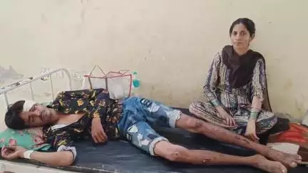 बुरहानपुर नगर: बुरहानपुर में पुरानी रंजिश के चलते दो लोगों ने एक युवक पर लाठी-डंडों से किया हमला, अस्पताल में भर्ती
