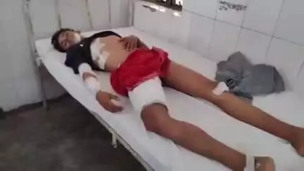 रसूलाबाद: थाना पुरवा पेट्रोल पंप के समीप डीसीएम की टक्कर से बाइक सवार 3 घायल, सीएचसी में उपचार के बाद 2 को हैलट रेफर किया गया