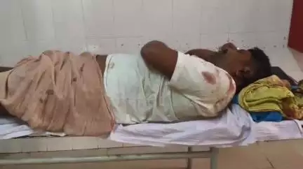 चकिया: काकोरियां में पानी पीने के विवाद में हुई मारपीट, 3 लोग हुए घायल
